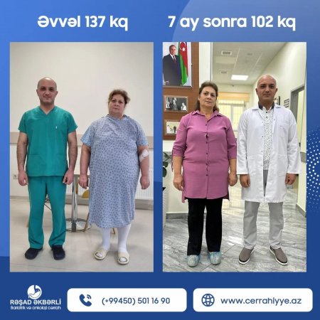 Bariatrik və Onkoloji cərrah Op.dr. Rəşad Əkbərli